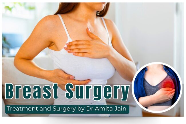 Best laparoscopic surgeon for breast surgery Dr Amita Jain